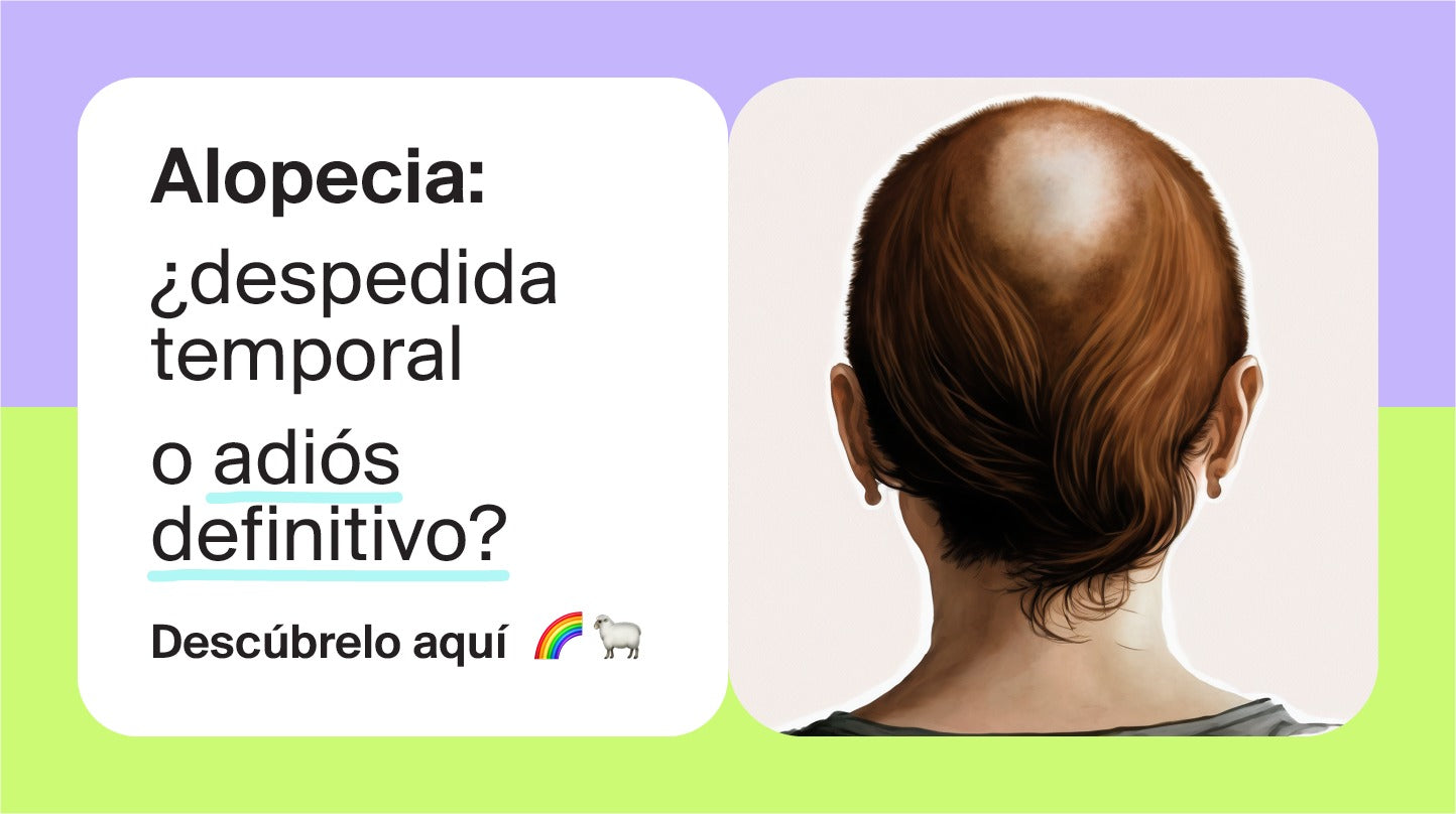 ¿La alopecia es temporal? Conoce los tipos y las causas