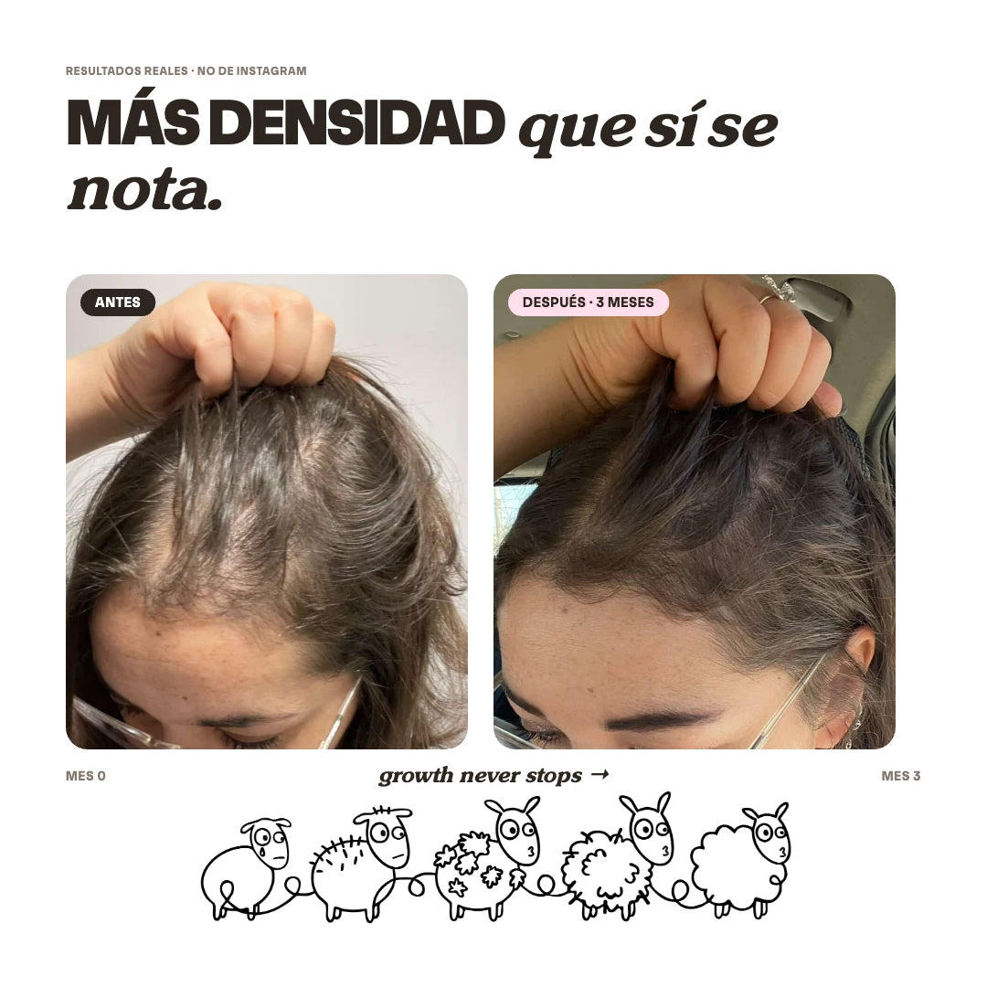 Shampoo Anticaída