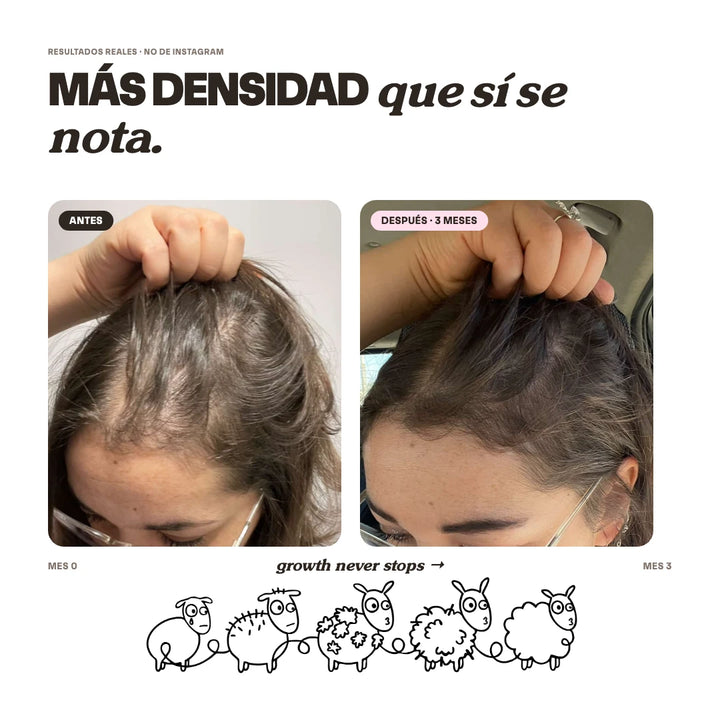 Shampoo Anticaída