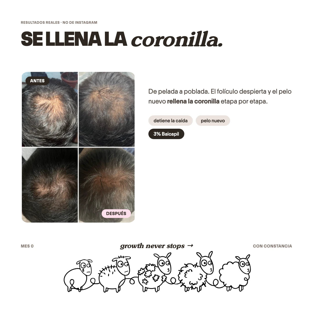 Tratamiento Anticaída de Pelo para 1 Mes + Biotina