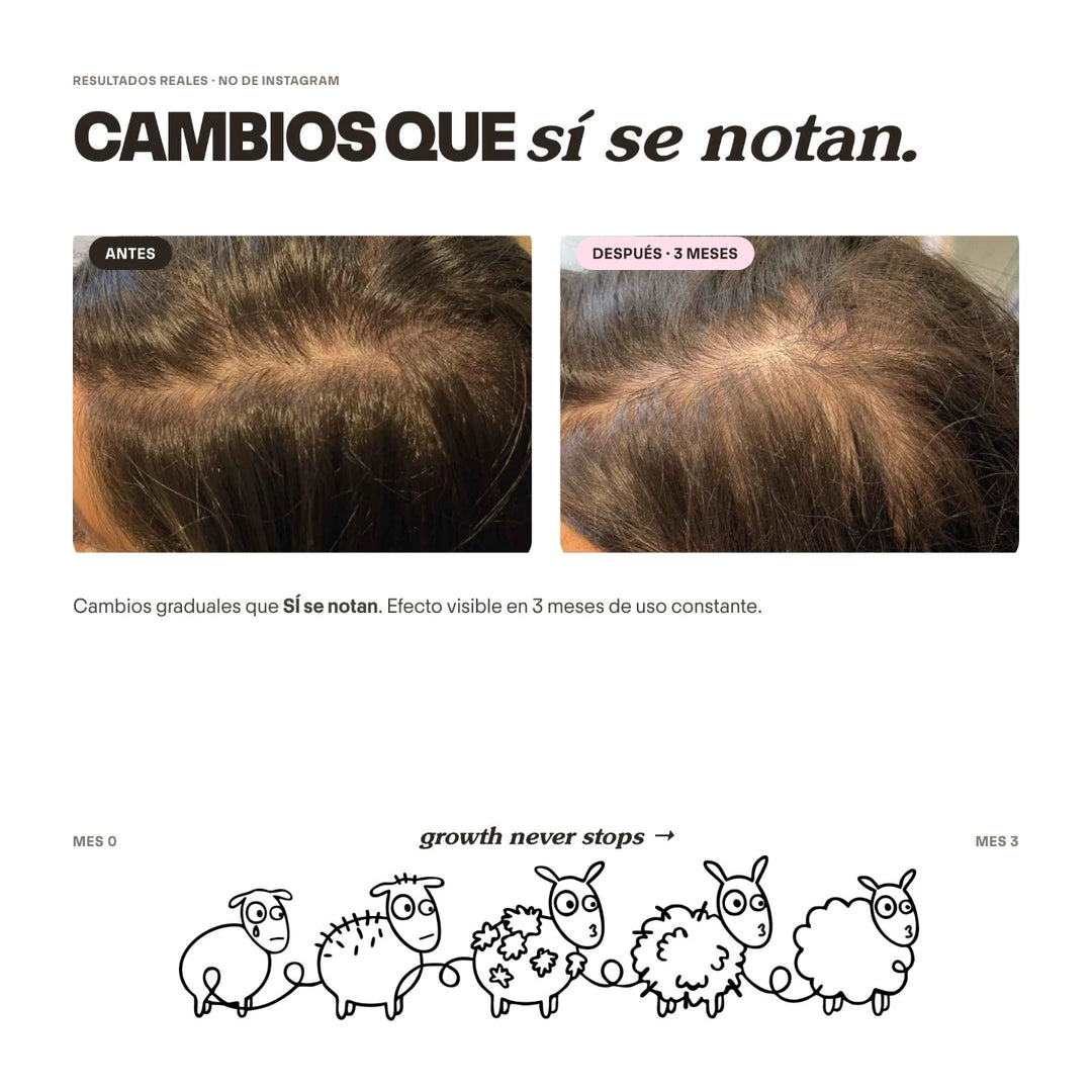 Shampoo Anticaída