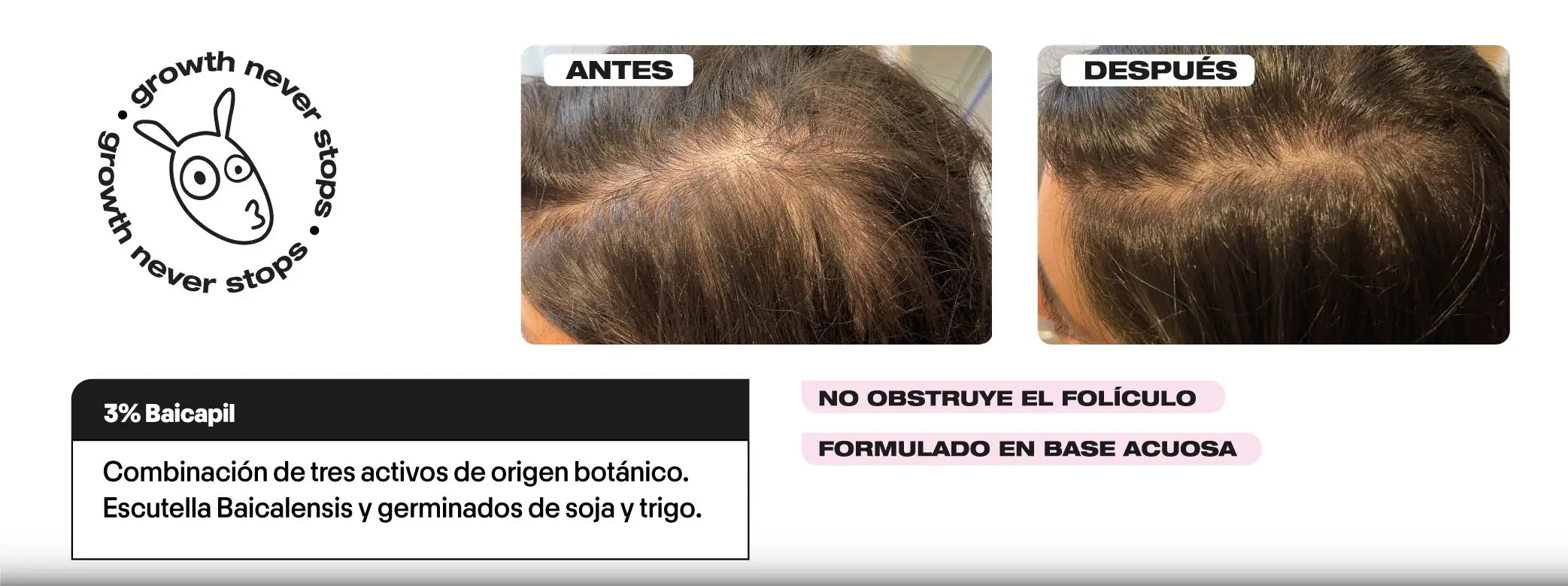 crecimiento cabello