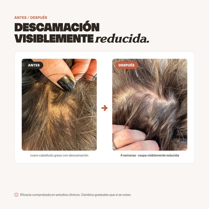 Shampoo Anticaspa para Caspa Grasa con Usneo | SHEET