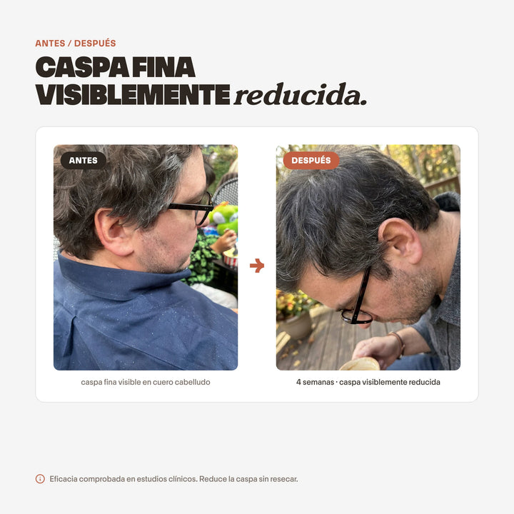 Shampoo Anticaspa Sin Sulfatos para Caspa Seca | SHEET