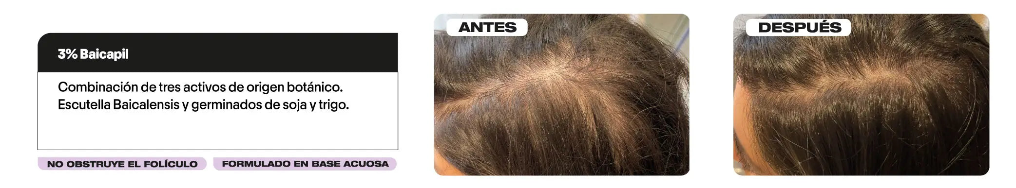 crecimiento cabello